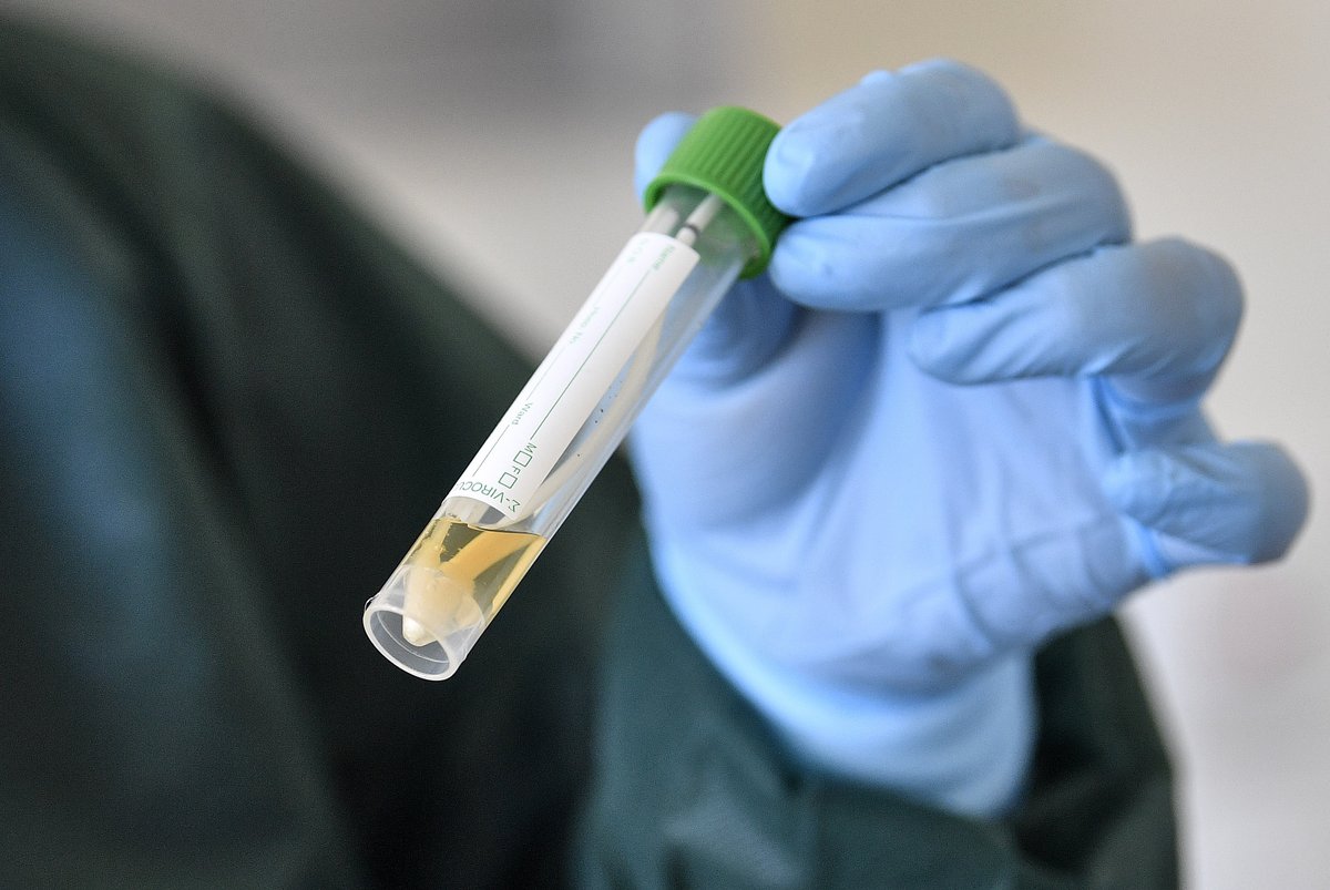 Россияне смогут получать результаты тестов на коронавирус через сайт госуслуг